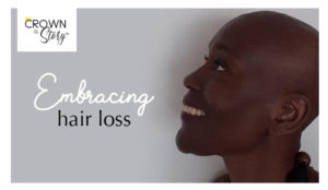 Embracing hair loss blog header image