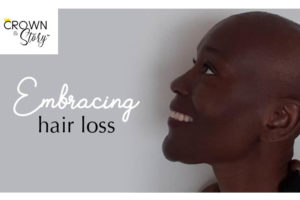 Embracing hair loss blog header image